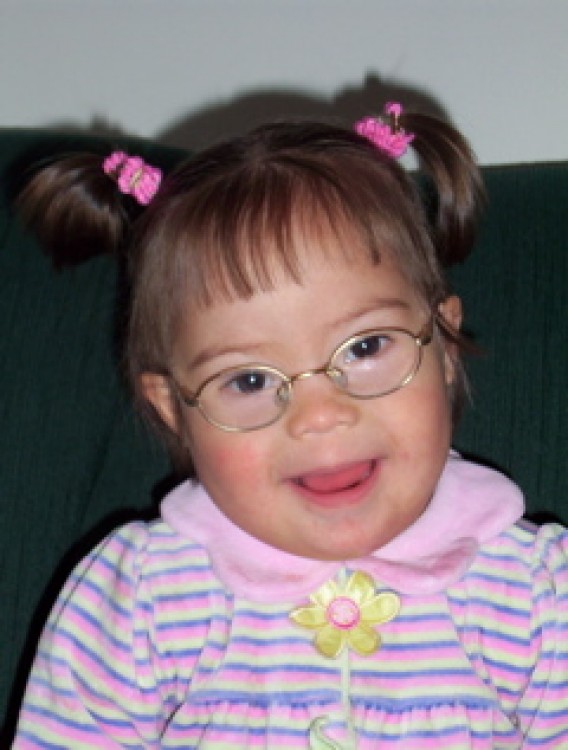 Angie, Our Angel with Down Syndrome