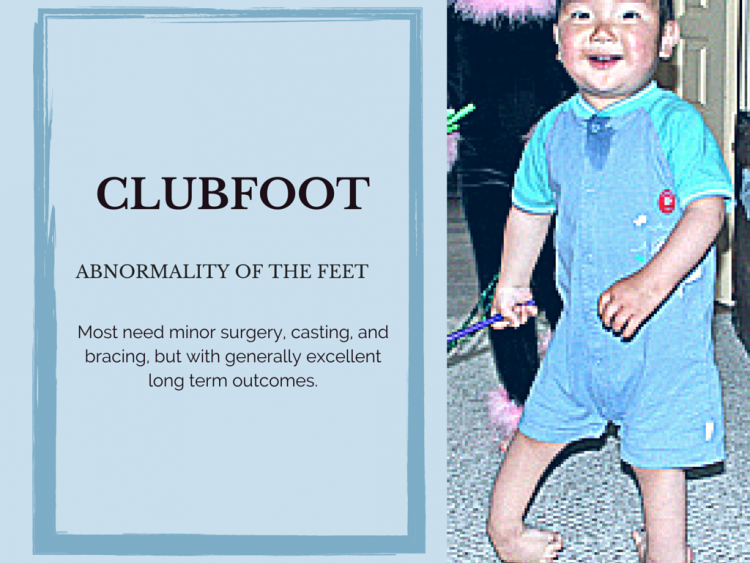Special Need Spotlight: Clubfoot