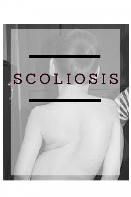 Scoliosis Treatment and Prognosis